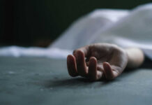 Dead persons hand lying on a gray surface