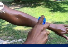 What to know about the FDA's newly approved sunscreen ingredient