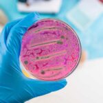 A hand holding a petri dish with pink bacterial growth