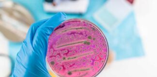 NOW: Deadly Bug Traces Back To Mexico! A hand holding a petri dish with pink bacterial growth